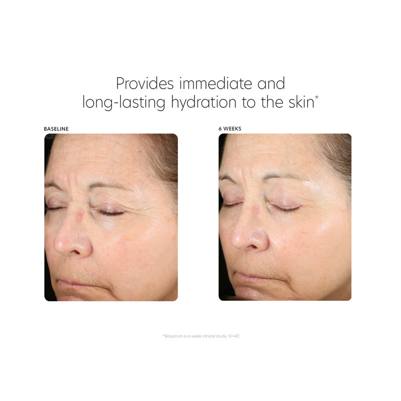 PCA SKIN Hyaluronic Acid Boosting Serum (1 fl oz)