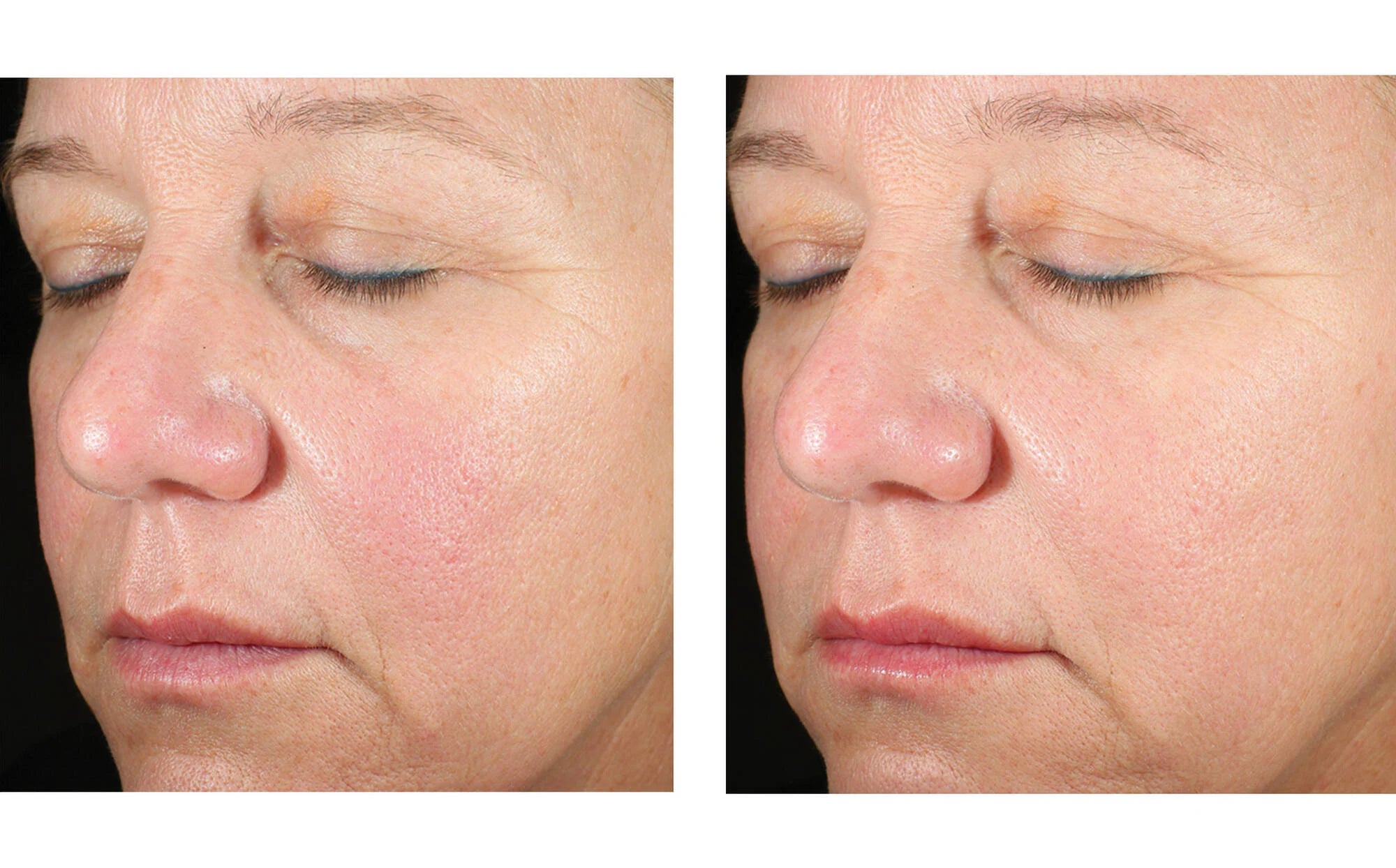 Skinbetter Alto Advanced Defense And Repair Serum (1 fl oz)