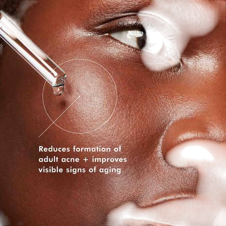 Skinceuticals Blemish + Age Defense