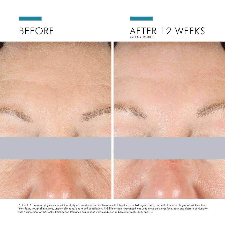 Skinceuticals A.G.E. Interrupter Advanced (1.7 fl oz)