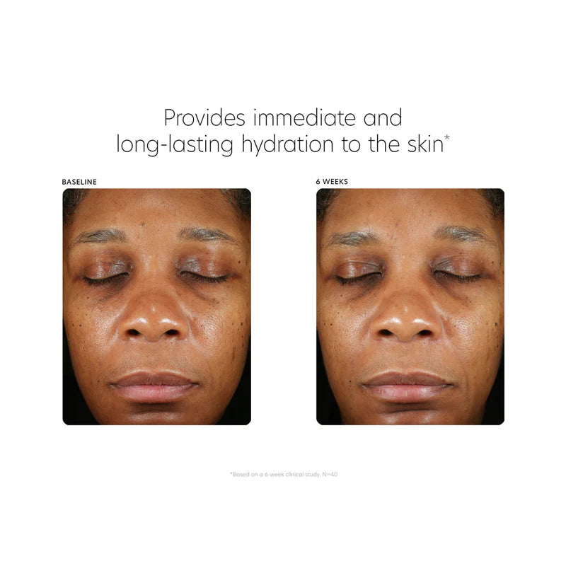 PCA SKIN Hyaluronic Acid Boosting Serum (1 fl oz)