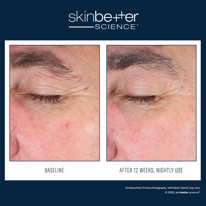 Skinbetter Eyemax Alpharet Overnight Cream