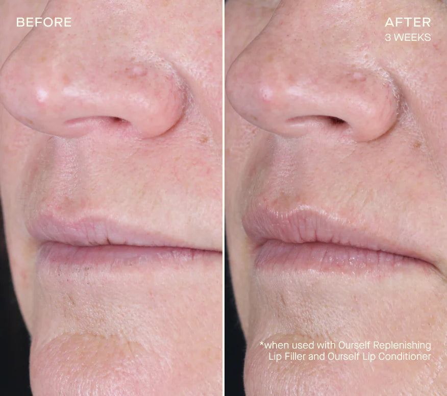 Ourself Replenishing Lip Filler Refill