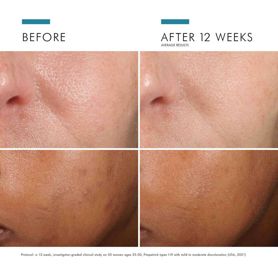 Skinceuticals Phloretin CF (1 fl oz)