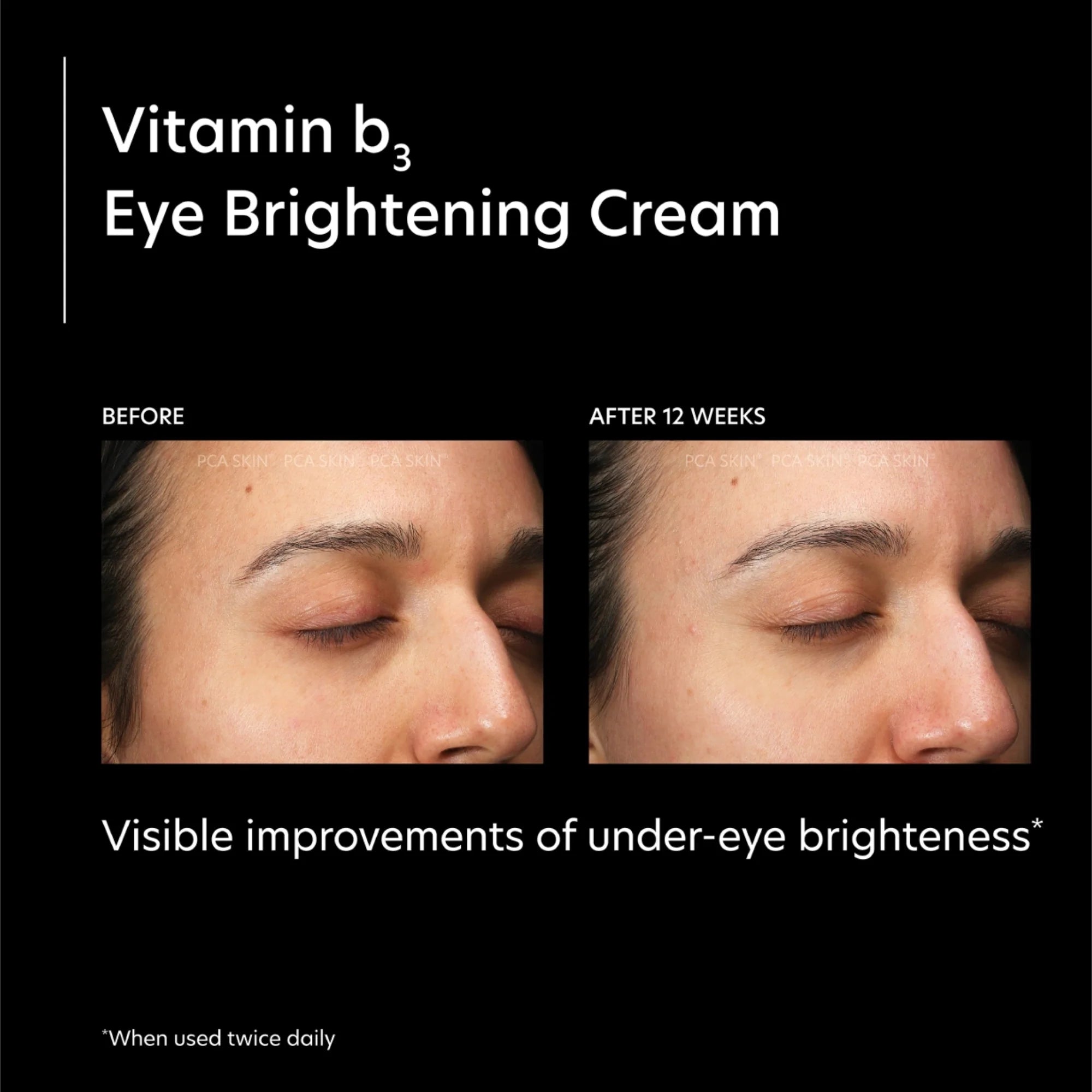 PCA Skin Vitamin b3 Eye Brightening Cream (0.46 fl oz)