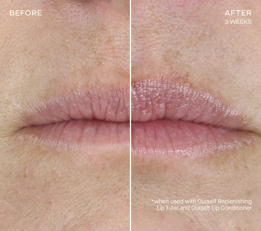 Ourself Replenishing Lip Filler Refill