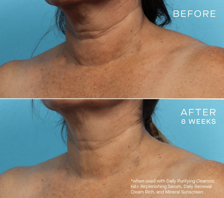 Ourself HA+Replenishing Serum