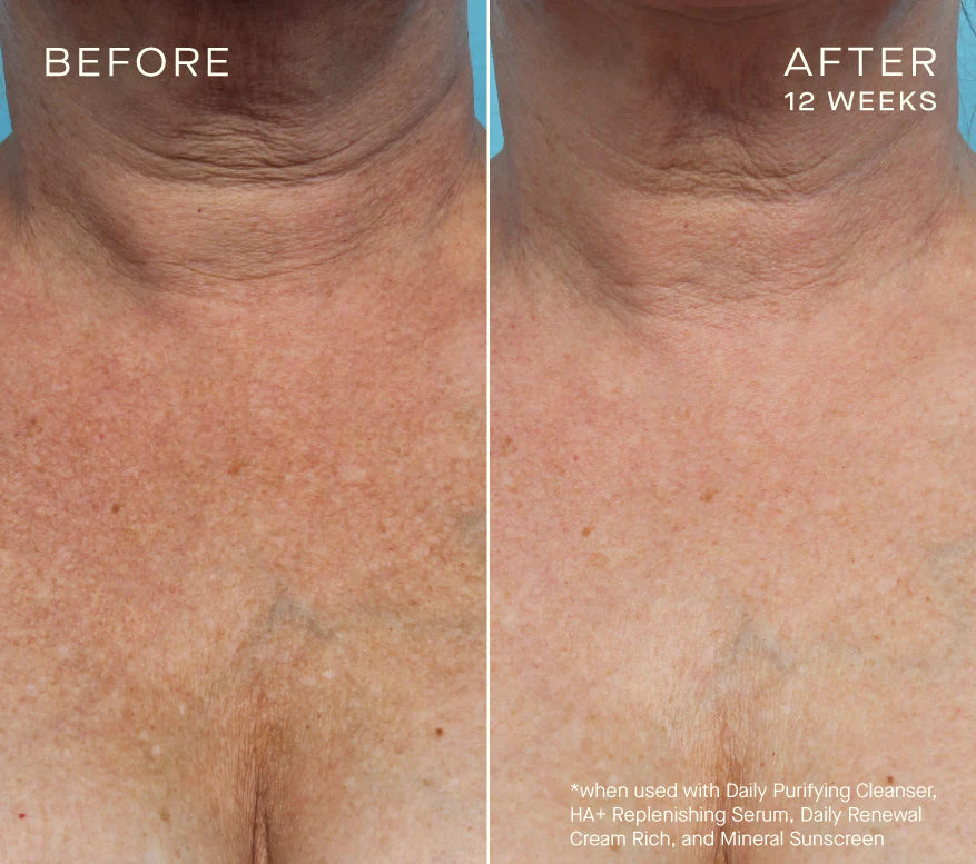 Ourself HA+Replenishing Serum