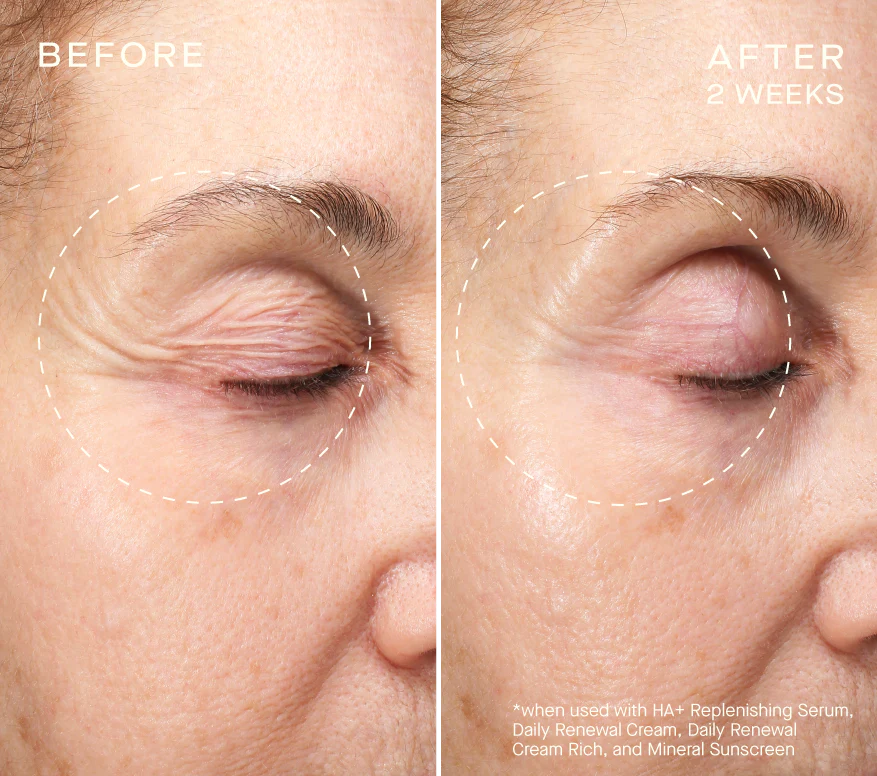 Ourself HA+Replenishing Serum